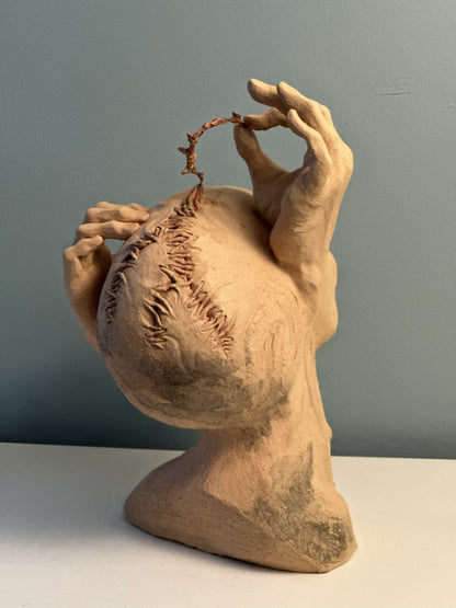 Chirurgie de la mémoire