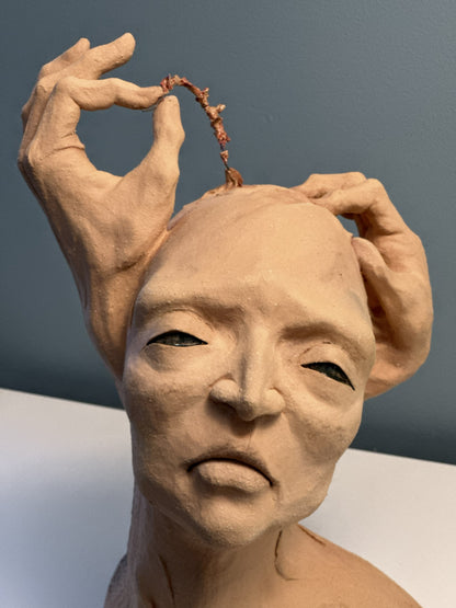 Chirurgie de la mémoire
