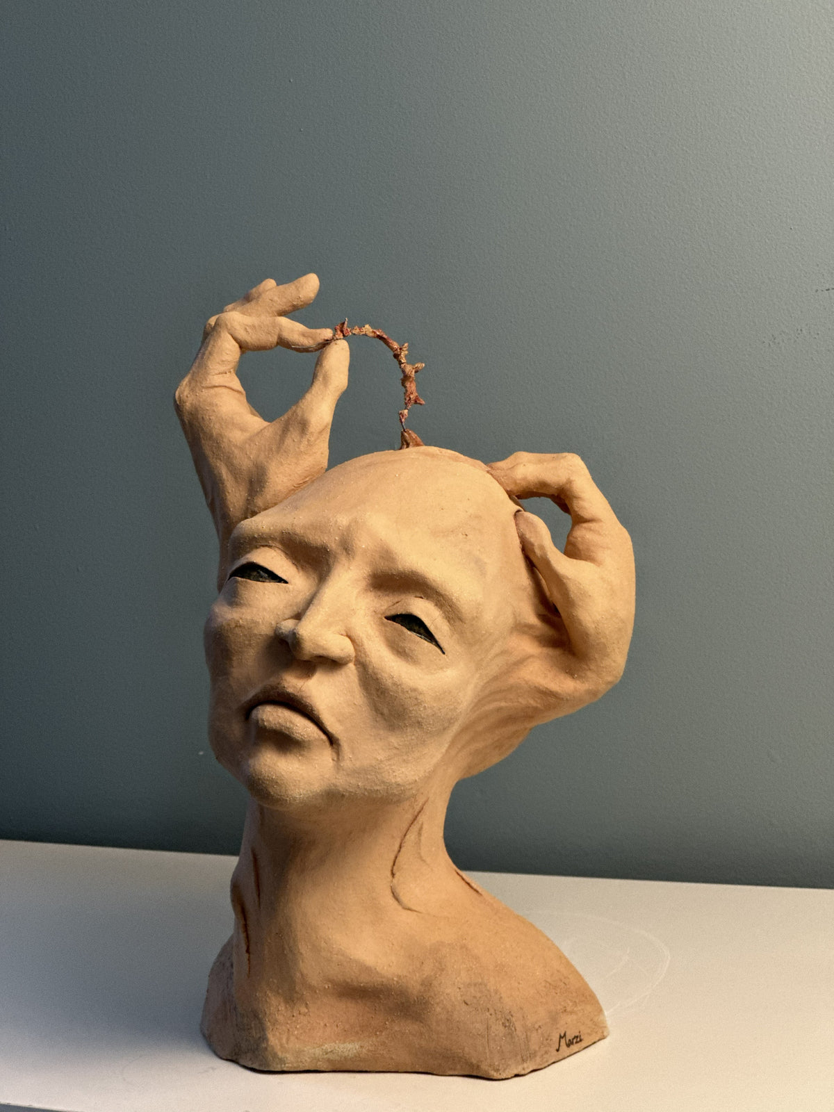 Chirurgie de la mémoire
